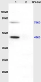 Anti-NP1 antibody used in Western Blot (WB). GTX51589
