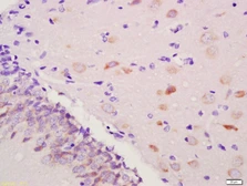 Anti-PGT antibody used in IHC (Paraffin sections) (IHC-P). GTX51606