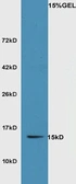 Anti-SRX1 antibody used in Western Blot (WB). GTX51959