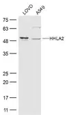 Anti-HHLA2 antibody used in Western Blot (WB). GTX51981