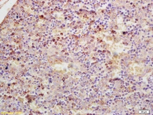 Anti-GDPD3 antibody used in IHC (Paraffin sections) (IHC-P). GTX52060