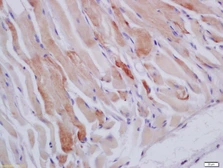 Anti-HSPB7 antibody used in IHC (Paraffin sections) (IHC-P). GTX52159