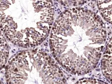 Anti-SHARPIN antibody used in IHC (Paraffin sections) (IHC-P). GTX52193