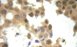 Anti-GRF1 (phospho Tyr1105) antibody used in IHC (Paraffin sections) (IHC-P). GTX52344