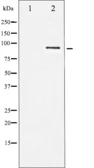 Anti-STAT5B antibody used in Western Blot (WB). GTX52362