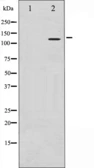 Anti-HDAC9 antibody used in Western Blot (WB). GTX52378