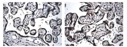 Anti-BMPR1B antibody [3E12] used in IHC (Paraffin sections) (IHC-P). GTX52506