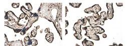 Anti-Activin Receptor Type IIB antibody [6L11] used in IHC (Paraffin sections) (IHC-P). GTX52510