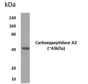 Anti-CPA2 antibody [11M21] used in Western Blot (WB). GTX52573