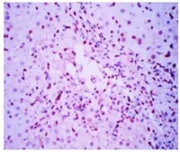 Anti-NKp46 antibody [8F24] used in IHC (Frozen sections) (IHC-Fr). GTX52945