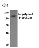 Anti-Pappalysin 2 antibody [8M12] used in Western Blot (WB). GTX52960