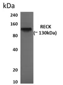 Anti-RECK antibody [9G19] used in Western Blot (WB). GTX52976