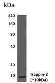 Anti-Elafin antibody [1A9] used in Western Blot (WB). GTX53037