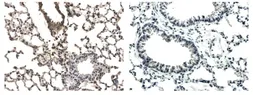 Anti-VEGF Receptor 1 antibody [5F13] used in IHC (Paraffin sections) (IHC-P). GTX53092