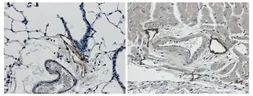 Anti-LYVE1 antibody [4D17] used in IHC (Paraffin sections) (IHC-P). GTX53124