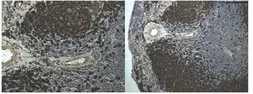 Anti-CD45R antibody [9F14] used in IHC (Paraffin sections) (IHC-P). GTX53152