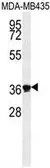Anti-Exonuclease 5 antibody used in Western Blot (WB). GTX53538