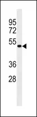 Anti-MCIDAS antibody used in Western Blot (WB). GTX53649