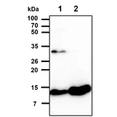 Anti-Cystatin B antibody [2F1] used in Western Blot (WB). GTX53707