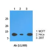 Anti-LSM2 antibody [AT2B2] used in Western Blot (WB). GTX53737