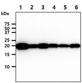 Anti-MYL4 antibody [AT4E8] used in Western Blot (WB). GTX53747