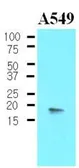 Anti-CPI-17 antibody [4H10] used in Western Blot (WB). GTX53770