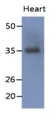 Anti-delta Sarcoglycan antibody [AT19G8] used in Western Blot (WB). GTX53783