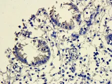 Anti-Mannose Receptor antibody used in IHC (Paraffin sections) (IHC-P). GTX53806