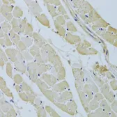 Anti-Carbonic Anhydrase III antibody used in IHC (Paraffin sections) (IHC-P). GTX53907