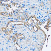 Anti-CAPZA2 antibody used in IHC (Paraffin sections) (IHC-P). GTX53918
