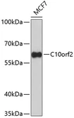 Anti-Twinkle antibody used in Western Blot (WB). GTX53922