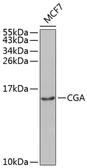 Anti-hCG alpha antibody used in Western Blot (WB). GTX53936