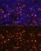 Anti-CLEC4D antibody used in IHC (Paraffin sections) (IHC-P). GTX53950