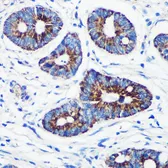 Anti-CPT1A antibody used in IHC (Paraffin sections) (IHC-P). GTX53954