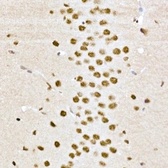 Anti-CREB (phospho Ser133) antibody used in IHC (Paraffin sections) (IHC-P). GTX53975