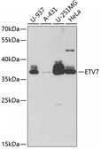 Anti-ETV7 antibody used in Western Blot (WB). GTX53979