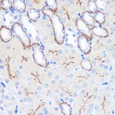 Anti-CD64 antibody used in IHC (Paraffin sections) (IHC-P). GTX53995
