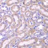 Anti-FADD antibody used in IHC (Paraffin sections) (IHC-P). GTX54024
