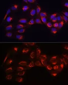 Anti-Hexokinase 1 antibody used in Immunocytochemistry/ Immunofluorescence (ICC/IF). GTX54080
