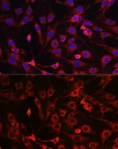 Anti-HMGCR antibody used in Immunocytochemistry/ Immunofluorescence (ICC/IF). GTX54088