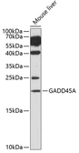 Anti-GADD45A antibody used in Western Blot (WB). GTX54090