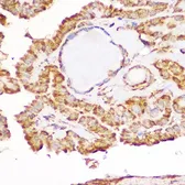 Anti-GDNF Receptor alpha 1 antibody used in IHC (Paraffin sections) (IHC-P). GTX54146