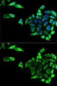 Anti-GOT1 antibody used in Immunocytochemistry/ Immunofluorescence (ICC/IF). GTX54155