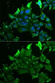 Anti-GRK6 antibody used in Immunocytochemistry/ Immunofluorescence (ICC/IF). GTX54160