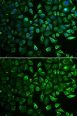 Anti-IMPA1 antibody used in Immunocytochemistry/ Immunofluorescence (ICC/IF). GTX54348