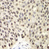 Anti-MCM6 antibody used in IHC (Paraffin sections) (IHC-P). GTX54353