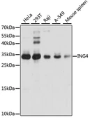 Anti-ING4 antibody used in Western Blot (WB). GTX54365