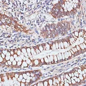 Anti-PIGR antibody used in IHC (Paraffin sections) (IHC-P). GTX54608