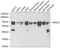 Anti-NR2C2 antibody used in Western Blot (WB). GTX54615