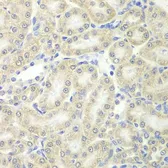 Anti-Peroxiredoxin 5 antibody used in IHC (Paraffin sections) (IHC-P). GTX54632